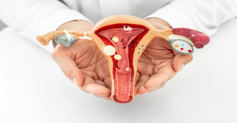 Rahim İçi (Endometrium) Polip