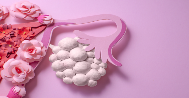 Polikistik over sendromu olan kişiler çocuk sahibi olabilir mi?